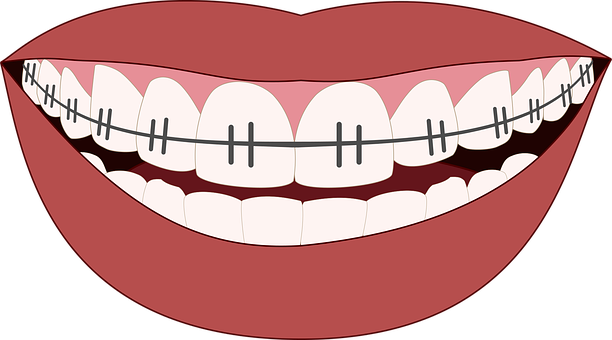 orthodontics-3109763__340.png